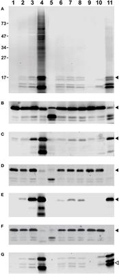 Current Challenges and Limitations in Antibody-Based Detection of Citrullinated Histones